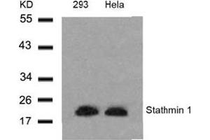 Image no. 3 for anti-Stathmin 1 (STMN1) (Ser24) antibody (ABIN197454) (Stathmin 1 Antikörper  (Ser24))