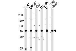 Western blot analysis of lysates from K562, LNCaP, PC-3 cell line, mouse brain, mouse kidney, rat liver tissue lysate (from left to right), using C Antibody (C-term) (ABIN6243097 and ABIN6577815). (CD164 Antikörper  (C-Term))