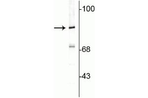 Western blot of rat cortical lysate showing specific immunolabeling of the ~82 kDa rabphilin 3A. (RPH3A Antikörper  (C-Term))