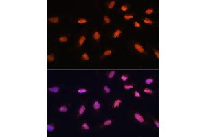 Immunofluorescence analysis of U-2 OS cells using BA antibody (ABIN7265937) at dilution of 1:100. (BAZ2A Antikörper)