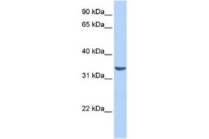 Western Blotting (WB) image for anti-RAB40A, Member RAS Oncogene Family (RAB40A) antibody (ABIN2463532)