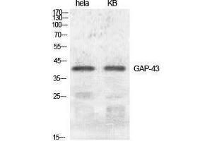 Western Blotting (WB) image for anti-Growth Associated Protein 43 (GAP43) (Ser421) antibody (ABIN3184740) (GAP43 Antikörper  (Ser421))