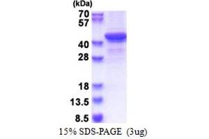 SDS-PAGE (SDS) image for Bestrophin 1 (BEST1) (AA 292-585) protein (His tag) (ABIN5853599) (Bestrophin 1 Protein (BEST1) (AA 292-585) (His tag))