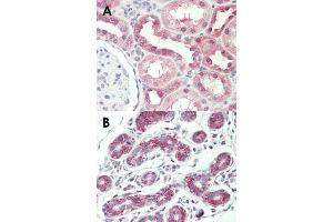 Immunohistochemical staining (Formalin-fixed paraffin-embedded sections) of human kidney (A) and human breast (B) with AVPR1A monoclonal antibody, clone 721CT25.