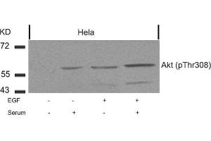 Western blot analysis of extracts from Hela cells untreated or treated with EGF, serum or both using Akt(Phospho-Thr308) Antibody. (AKT1 Antikörper  (pThr308))