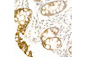 Immunohistochemistry (IHC) image for anti-Ubiquitin Specific Peptidase 18 (USP18) (AA 200-300) antibody (ABIN7271145)
