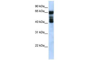 UGT2B4 antibody used at 1 ug/ml to detect target protein. (UGT2B4 Antikörper  (N-Term))