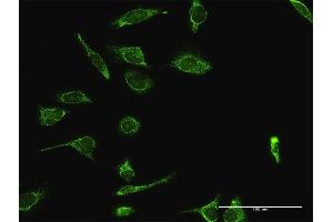 Immunofluorescence (IF) image for anti-Heat Shock 70kDa Protein 9 (Mortalin) (HSPA9) (AA 1-679) antibody (ABIN516738)