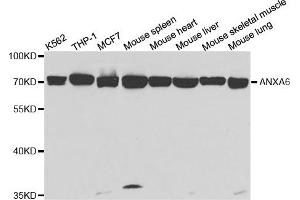 Western Blotting (WB) image for anti-Annexin A6 (ANXA6) antibody (ABIN1876578) (ANXA6 Antikörper)