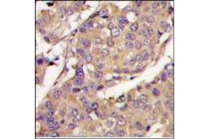 Image no. 2 for anti-Ubiquitin-Conjugating Enzyme E2L 6 (UBE2L6) (C-Term) antibody (ABIN357496) (UBE2L6 Antikörper  (C-Term))