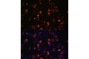 Immunofluorescence analysis of C6 cells using CCDC47 antibody (ABIN7266438) at dilution of 1:100. (CCDC47 Antikörper  (AA 224-483))