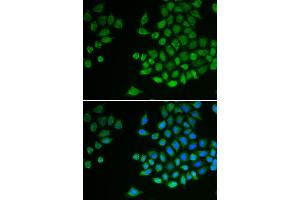 Immunofluorescence analysis of MCF-7 cells using PTPN2 antibody (ABIN5970915). (PTPN2 Antikörper)
