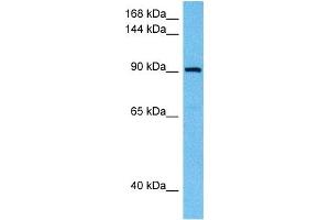 Host:  Rabbit  Target Name:  SAFB  Sample Tissue:  Human THP-1 Whole Cell lysates  Antibody Dilution:  1ug/ml (SAFB Antikörper  (N-Term))