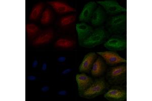 ABIN6257757 and ABIN6275874 staining  cells by IF/ICC. (LY75/DEC-205 Antikörper  (Internal Region))