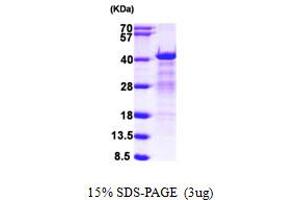 HNRNPC Protein (AA 1-293) (His tag)