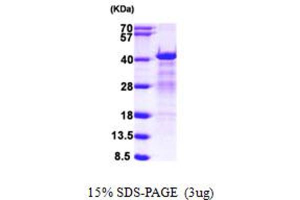 HNRNPC Protein (AA 1-293) (His tag)