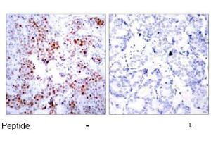 Image no. 1 for anti-Activating Transcription Factor 2 (ATF2) (Thr51), (Thr69) antibody (ABIN197146)