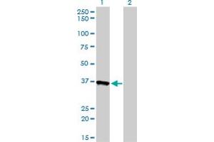 Western Blotting (WB) image for anti-Aldo-Keto Reductase Family 1, Member A1 (Aldehyde Reductase) (AKR1A1) (AA 1-326) antibody (ABIN599129) (AKR1A1 Antikörper  (AA 1-326))
