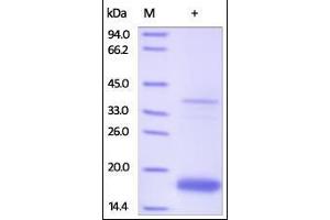 Human Transthyretin, His Tag on SDS-PAGE under reducing (R) condition. (TTR Protein (AA 21-147) (His tag))