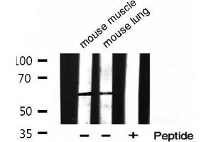 Western Blotting (WB) image for anti-Histone Deacetylase 2 (HDAC2) (pSer394) antibody (ABIN6256313)
