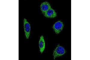 Confocal immunofluorescent analysis of ADRA2B Antibody (Center) (ABIN652506 and ABIN2842340) with MDA-M cell followed by Alexa Fluor® 488-conjugated goat anti-rabbit lgG (green). (ADRA2B Antikörper  (AA 343-369))