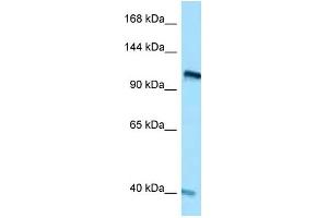 WB Suggested Anti-RET Antibody Titration: 1.