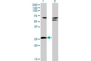 Western Blot analysis of ZNF266 expression in transfected 293T cell line by ZNF266 monoclonal antibody (M02), clone 4G5. (ZNF266 Antikörper  (AA 274-346))