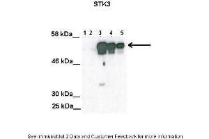 Lanes:   Lane1: 100ug untransfected COS-7 lysate Lane2: 100ug mock transfected Cos-7 lysate Lane3: 100ug STK3 transfected Cos-7 lysate Lane4: 50 ug STK3 transfected Cos-7 lysate Lane5: 25 ug STK3 transfected Cos-7 lysate  Primary Antibody Dilution:   1:2000  Secondary Antibody:   Anti-rabbit HRP  Secondary Antibody Dilution:   1:5000  Gene Name:   STK3  Submitted by:   Anonymous
