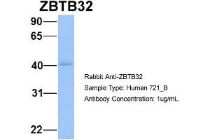 Host: Rabbit Target Name: WT1 Sample Type: 721_B Antibody Dilution: 1. (ZBTB32 Antikörper  (N-Term))