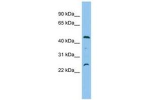 Image no. 1 for anti-Organic Solute Carrier Partner 1 (OSCP1) (AA 35-84) antibody (ABIN6745039) (OSCP1 Antikörper  (AA 35-84))