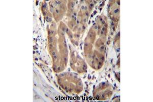 ABHD2 Antibody (Center) immunohistochemistry analysis in formalin fixed and paraffin embedded human stomach tissue followed by peroxidase conjugation of the secondary antibody and DAB staining. (ABHD2 Antikörper  (Middle Region))