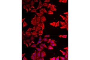 Immunofluorescence analysis of MCF7 cells using THRSP Polyclonal Antibody