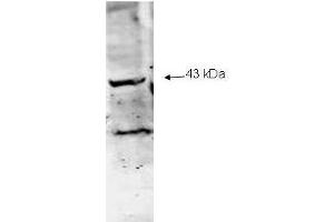 Western blot analysis using  Immunochemical's Affinity Purified anti-Neu2 antibody to detect Neu-2 present in a lysate expressing human Neu2 (1. (NEU1 Antikörper  (AA 100-125))
