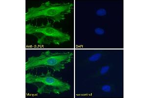 ABIN5539774 Immunofluorescence analysis of paraformaldehyde fixed HeLa cells, permeabilized with 0. (GLP1R Antikörper  (Internal Region))
