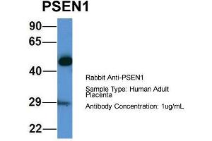 Host: Rabbit  Target Name: PSEN1  Sample Tissue: Human Adult Placenta  Antibody Dilution: 1. (Presenilin 1 Antikörper  (Middle Region))
