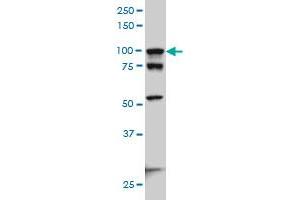 ACTN4 monoclonal antibody (M01A), clone 4D10 Western Blot analysis of ACTN4 expression in Hela S3 NE . (alpha Actinin 4 Antikörper  (AA 592-701))
