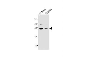 All lanes : Anti-NTF3 Antibody (C-term) at 1:2000 dilution Lane 1: Human brain lysate Lane 2: Rat brain lysate Lysates/proteins at 20 μg per lane.