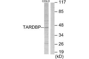 Western blot analysis of extracts from COLO205 cells, using TBX1 antibody. (T-Box 1 Antikörper  (C-Term))