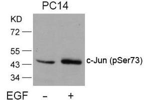 Western blot analysis of extracts from PC14 cells untreated or treated with EGF using c-Jun(Phospho-Ser73) Antibody. (C-JUN Antikörper  (pSer73))