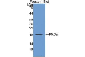 Western Blotting (WB) image for anti-Heat Shock 105kDa/110kDa Protein 1 (HSPH1) (AA 595-733) antibody (ABIN1078105)