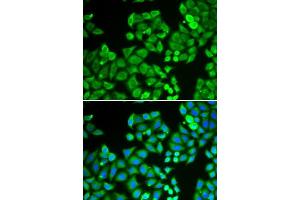 Immunofluorescence analysis of U2OS cells using PPP4C antibody. (PPP4C Antikörper  (AA 1-307))