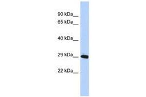 Image no. 1 for anti-Zinc Finger Protein 524 (ZNF524) (AA 35-84) antibody (ABIN6740642) (ZNF524 Antikörper  (AA 35-84))