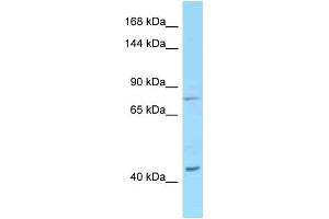 Western Blotting (WB) image for anti-Desmoglein 1 (DSG1) (C-Term) antibody (ABIN2789462) (Desmoglein 1 Antikörper  (C-Term))
