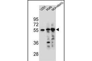 SYNCI Antibody (N-term) (ABIN654757 and ABIN2844441) western blot analysis in ,A549 and MDA-M cell line lysates (35 μg/lane). (Syncoilin Antikörper  (N-Term))
