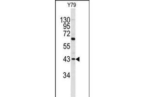 Western blot analysis of PRELP antibody (C-term) (ABIN390612 and ABIN2840924) in Y79 cell line lysates (35 μg/lane). (PRELP Antikörper  (C-Term))