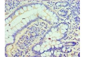 Immunohistochemistry of paraffin-embedded human small intestine tissue using ABIN7147585 at dilution of 1:100 (CLIC1 Antikörper  (AA 42-241))