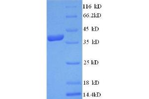 Transthyretin (TTR) (AA 21-147) protein (His tag) expressed in E. (TTR Protein (AA 21-147) (His tag))