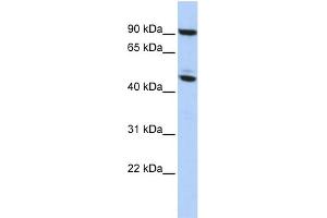 WB Suggested Anti-MECP2 Antibody Titration:  0. (MECP2 Antikörper  (N-Term))
