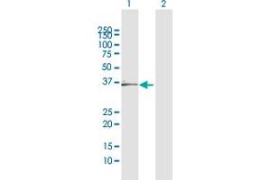 Western Blotting (WB) image for anti-Complement Factor H-Related 1 (CFHR1) (AA 1-330) antibody (ABIN516410)