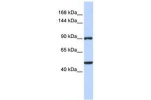 Image no. 1 for anti-Zinc Finger Protein 217 (ZNF217) (AA 540-589) antibody (ABIN6742392)